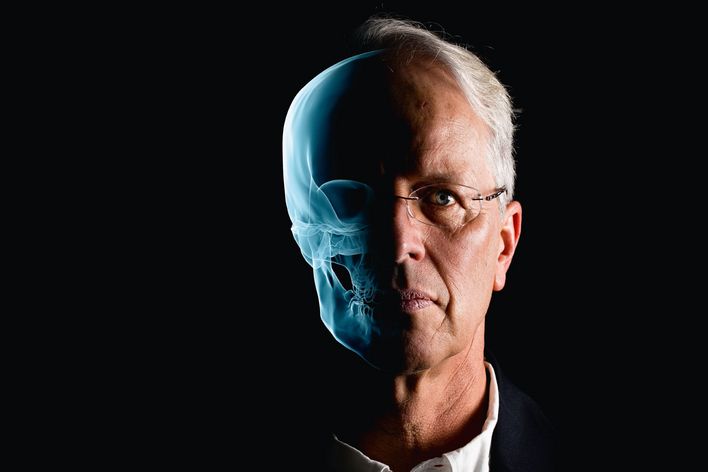 Klassische Röntgenbilder wie hier haben nur eine geringe Auflösung. Mit William Graves’ Strahlen werden deutlich bessere Aufnahmen möglich.